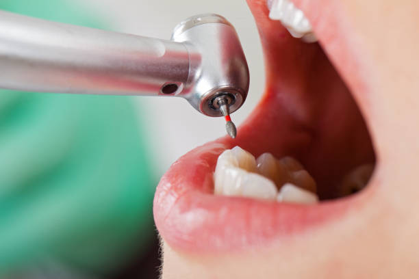 Best Affordable Emergency Dental Care  in Baltimore, MD